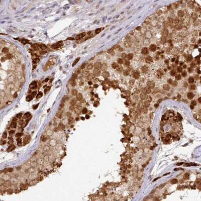 Immunohistochemistry-Paraffin: RANBP9 Antibody [NBP2-47315] - Staining of human testis shows strong cytoplasmic and nuclear positivity in cells in seminiferus ducts, Leydig cells exhibited strong cytoplasmic staining.