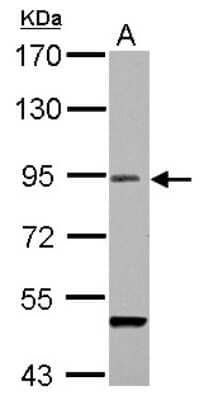 Western Blot: RANBP9 Antibody [NBP2-15087] - Sample (30 ug of whole cell lysate) A: BCL-1 7. 5% SDS PAGE; antibody diluted at 1:1000.