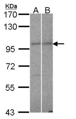 Western Blot: RANBP9 Antibody [NBP2-15087] - Sample (30 ug of whole cell lysate) A: Hela B: NT2D1 7. 5% SDS PAGE; antibody diluted at 1:1000.