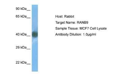 Western Blot: RANBP9 Antibody [NBP2-85593] - Host: Rabbit. Target Name: RANB9. Sample Type: MCF7 Whole Cell. Antibody Dilution: 1.0ug/ml