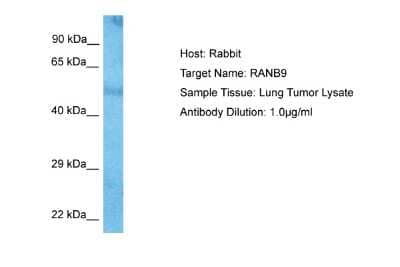 Western Blot: RANBP9 Antibody [NBP2-85594] - Host: Rabbit. Target Name: RANB9. Sample Type: Lung Tumor lysates. Antibody Dilution: 1.0ug/ml