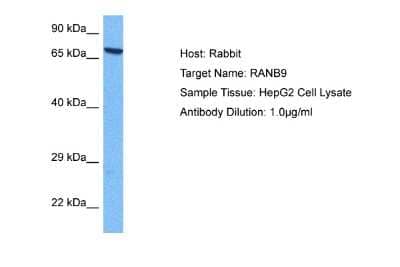 Western Blot: RANBP9 Antibody [NBP2-85596] - Host: Rabbit. Target Name: RANBP9. Sample Tissue: Human HepG2 Whole Cell. Antibody Dilution: 1.0ug/ml