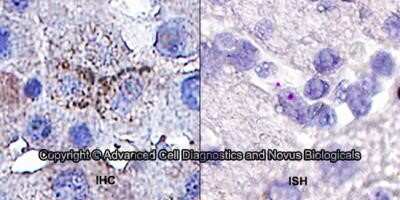 Dual RNAscope ISH-IHC: RANK/TNFRSF11A Antibody (64C1385.1) - Azide Free [NBP2-33256] - Formalin-fixed paraffin-embedded tissue sections of human liver were probed for RANK/TNFRSF11A mRNA (ACD RNAScope Probe, catalog # 412281; Fast Red chromogen, ACD catalog # 322360). Adjacent tissue section was processed for immunohistochemistry using mouse anti-human (Novus Biologicals catalog # NBP2-24702) at 5 ug/mL with overnight incubation at 4 degrees Celsius followed by incubation with anti-mouse IgG VisUCyte HRP Polymer Antibody (Catalog # VC001) and DAB chromogen (yellow-brown). Tissue was counterstained with hematoxylin (blue). IHC signal is confined to plasma membrane. Image from the standard format of this antibody.