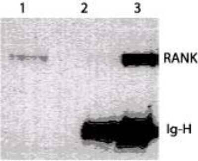 Western Blot: RANK/TNFRSF11A Antibody (64C1385.1) - Azide Free [NBP2-33256] - Detection of RANK in RAW cells. Lane 1. detection of RANK in RAW, a mouse cell line. Lane 2 & 3. IP/analysis of RANK. RANK protein from RAW cell lysate was immunoprecipitated either with control antibody (lane 2) or this antibody. RANK was detected by western blot using this antibody. Image from the standard format of this antibody.