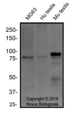 Western Blot: RANK/TNFRSF11A Antibody (64C1385.1) - Azide Free [NBP2-33256] - Total protein from MG63, human testis and mouse testis was separated on a 7.5% gel by SDS-PAGE, transferred to PVDF membrane and blocked in 5% non-fat milk in TBST. The membrane was probed with 2.0 ug/ml anti-RANK1 in 1% block buffer and detected with an anti-mouse HRP secondary antibody using chemiluminescence. Image from the standard format of this antibody.