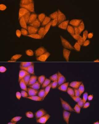 Immunocytochemistry/Immunofluorescence: RAP1B Antibody [NBP2-94183] - Analysis of HeLa cells using RAP1B . Blue: DAPI for nuclear staining.