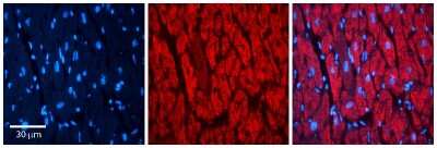 Immunohistochemistry: RAP1B Antibody [NBP1-54871] - Formalin Fixed Paraffin Embedded Tissue: Human heart Tissue Observed Staining: Cytoplasmic Primary Antibody Concentration: N/A Other Working Concentrations: 1:600 Secondary Antibody: Donkey anti-Rabbit-Cy3 Secondary Antibody Concentration: 1:200 Magnification: 20X Exposure Time: 0.5 - 2.0 sec