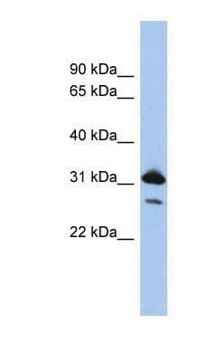 Western Blot RAP1B Antibody