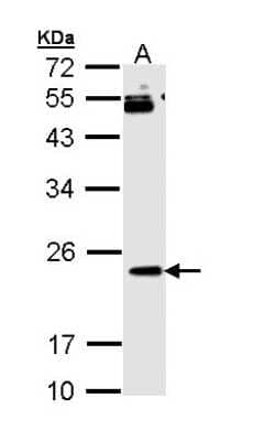 Western Blot: RAP1B Antibody [NBP2-20071] - Sample (30 ug of whole cell lysate) A: Molt-4 12% SDS PAGE gel, diluted at 1:1000.