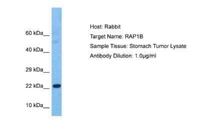 Western Blot: RAP1B Antibody [NBP2-82333] - Host: Rabbit. Target Name: RAP1B. Sample Tissue: Human Stomach Tumor. Antibody Dilution: 1.0ug/ml