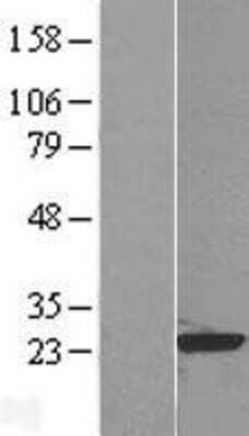 Western Blot RAP1B Overexpression Lysate