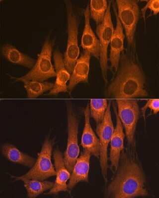 Immunocytochemistry/Immunofluorescence: RAP1GAP Antibody (8V9I6) [NBP3-16234] - Immunofluorescence analysis of NIH-3T3 cells using RAP1GAP Rabbit mAb (NBP3-16234) at dilution of 1:100 (40x lens). Blue: DAPI for nuclear staining.