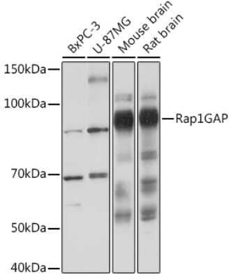 Western Blot: RAP1GAP Antibody (8V9I6) [NBP3-16234] - Western blot analysis of extracts of various cell lines, using RAP1GAP Rabbit mAb (NBP3-16234) at 1:1000 dilution. Secondary antibody: HRP Goat Anti-Rabbit IgG (H+L) at 1:10000 dilution. Lysates/proteins: 25ug per lane. Blocking buffer: 3% nonfat dry milk in TBST. Detection: ECL Basic Kit. Exposure time: 3s.