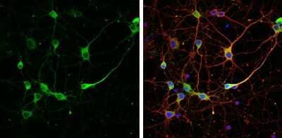 Immunocytochemistry/Immunofluorescence: RAP1GAP Antibody [NBP3-13216] - RAP1GAP antibody detects RAP1GAP protein by immunofluorescent analysis. Sample: DIV9 rat E18 primary cortical neuron cells were fixed in 4% paraformaldehyde at RT for 15 min. Green: RAP1GAP stained by RAP1GAP antibody (NBP3-13216) diluted at 1:500. Red: beta Tubulin 3/ Tuj1, stained by beta Tubulin 3/ Tuj1 antibody [GT1338] (NBP3-13505) diluted at 1:500. Blue: Fluoroshield with DAPI.