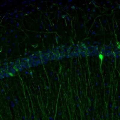 Immunohistochemistry: RAP1GAP Antibody [NBP1-83002] - Staining of mouse hippocampus shows cytoplasmic positivity in a subset of interneurons in the CA1 area.