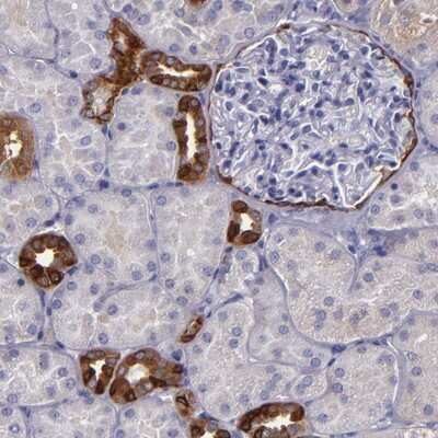 Immunohistochemistry-Paraffin: RAP1GAP Antibody [NBP1-83002] - Staining of human kidney shows strong positivity in distal tubules and Bowman's capsule.