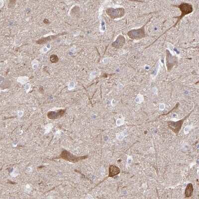 Immunohistochemistry-Paraffin: RAP1GAP Antibody [NBP1-83002] - Staining of human hippocampus shows cytoplasmic positivity in neuronal cells.