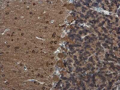 Immunohistochemistry-Paraffin: RAP1GAP Antibody [NBP3-13216] - RAP1GAP antibody detects RAP1GAP protein at cytoplasm in rat brain by immunohistochemical analysis. Sample: Paraffin-embedded rat brain. RAP1GAP antibody (NBP3-13216) diluted at 1:500. Antigen Retrieval: Citrate buffer, pH 6.0, 15 min