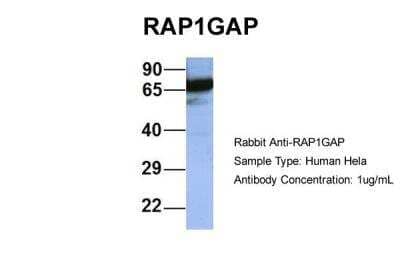 SDS-Page: RAP1GAP Antibody [NBP1-53072] - Human Hela, Antibody Dilution: 1.0 ug/ml RAP1GAP is supported by BioGPS gene expression data to be expressed in HeLa.