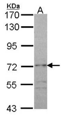 Western Blot: RAP1GAP Antibody [NBP1-33710] - Sample (30 ug of whole cell lysate) A: A431 7. 5% SDS PAGE, antibody diluted at 1:500.