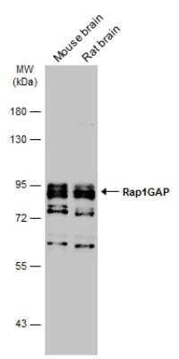 Western Blot: RAP1GAP Antibody [NBP1-33710] - Various tissue extracts (50 ug) were separated by 7.5% SDS-PAGE, and the membrane was blotted with Rap1GAP antibody [N2C2], Internal diluted at 1:1000. The HRP-conjugated anti-rabbit IgG antibody was used to detect the primary antibody, and the signal was developed with Trident ECL plus-Enhanced.