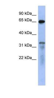 Western Blot: RAP1GAP Antibody [NBP1-53072] - Titration: 0.2-1 ug/ml, Positive Control: 293T cell lysate.