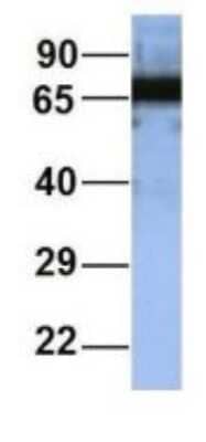 Western Blot: RAP1GAP Antibody [NBP1-53072] - Human 721_B, Antibody Dilution: 1.0 ug/ml RAP1GAP is supported by BioGPS gene expression data to be expressed in 721_B.