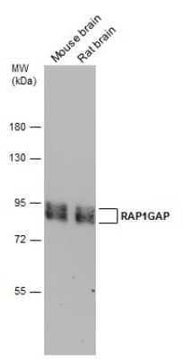 Western Blot: RAP1GAP Antibody [NBP3-13211] - Various tissue extracts (50 ug) were separated by 7.5% SDS-PAGE, and the membrane was blotted with RAP1GAP antibody (NBP3-13211) diluted at 1:2000.