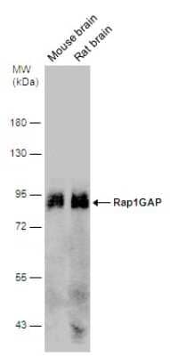 Western Blot: RAP1GAP Antibody [NBP3-13216] - Various tissue extracts (10 ug) were separated by 7.5% SDS-PAGE, and the membrane was blotted with RAP1GAP antibody (NBP3-13216) diluted at 1:1000.