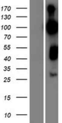Western Blot: RAP1GAP2 Overexpression Lysate (Adult Normal) [NBP2-07198] Left-Empty vector transfected control cell lysate (HEK293 cell lysate); Right -Over-expression Lysate for RAP1GAP2.