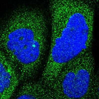 Immunocytochemistry/ Immunofluorescence RAP1GDS1 Antibody