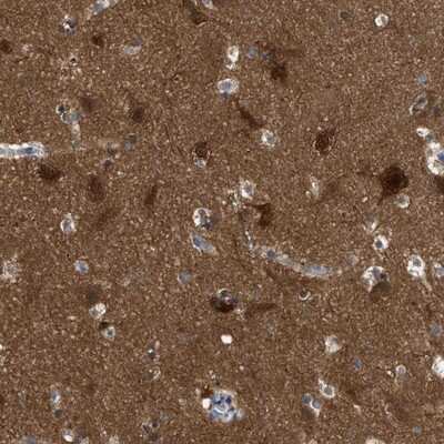 Immunohistochemistry-Paraffin RAP1GDS1 Antibody