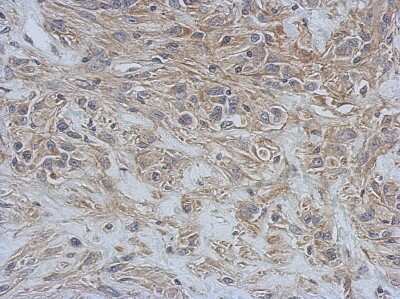Immunohistochemistry-Paraffin: RAP1GDS1 Antibody [NBP2-20073] - Immunohistochemical analysis of paraffin-embedded U373 xenograft, using antibody at 1:500 dilution.