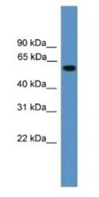 Western Blot: RAP1GDS1 Antibody [NBP1-69099] - Human lacenta Lysate 1ug/ml  Gel Concentration 12%