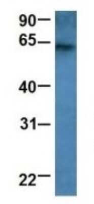 Western Blot: RAP1GDS1 Antibody [NBP1-69099] - Human Fetal Brain, Antibody Dilution: 1.0 ug/ml.