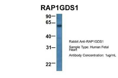 Western Blot: RAP1GDS1 Antibody [NBP1-69099] - Human Fetal Heart, Antibody Dilution: 1.0 ug/ml.