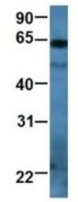 Western Blot: RAP1GDS1 Antibody [NBP1-69099] - Human Jurkat, Antibody Dilution: 1.0 ug/ml RAP1GDS1 is strongly supported by BioGPS gene expression data to be expressed in Human Jurkat cells.