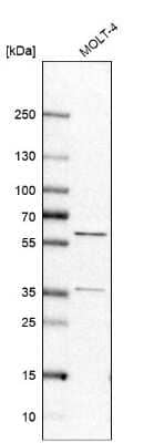 Western Blot RAP1GDS1 Antibody