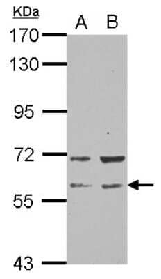Western Blot: RAP1GDS1 Antibody [NBP2-20073] - Sample (30 ug of whole cell lysate) A: NT2D1 B: PC-3 7. 5% SDS PAGE gel, diluted at 1:1000.