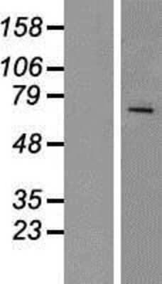 Western Blot: RAP1GDS1 Overexpression Lysate (Adult Normal) [NBP2-06554] Left-Empty vector transfected control cell lysate (HEK293 cell lysate); Right -Over-expression Lysate for RAP1GDS1.