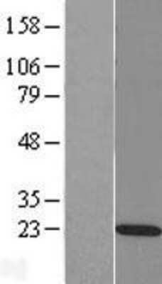 Western Blot: RAP2C Overexpression Lysate (Adult Normal) [NBL1-15150] Left-Empty vector transfected control cell lysate (HEK293 cell lysate); Right -Over-expression Lysate for RAP2C.