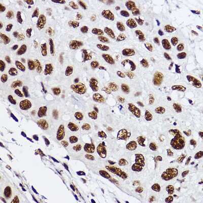 Immunohistochemistry-Paraffin: RAP30 Antibody (3T7Q9) [NBP3-15275] - Immunohistochemistry of paraffin-embedded human esophageal using RAP30 Rabbit mAb (NBP3-15275) at dilution of 1:100 (40x lens).Perform high pressure antigen retrieval with 10 mM citrate buffer pH 6.0 before commencing with IHC staining protocol.