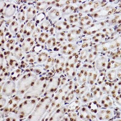 Immunohistochemistry-Paraffin: RAP30 Antibody (3T7Q9) [NBP3-15275] - Immunohistochemistry of paraffin-embedded mouse kidney using RAP30 Rabbit mAb (NBP3-15275) at dilution of 1:100 (40x lens).Perform high pressure antigen retrieval with 10 mM citrate buffer pH 6.0 before commencing with IHC staining protocol.