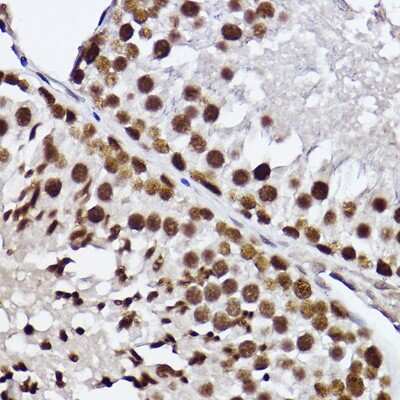 Immunohistochemistry-Paraffin: RAP30 Antibody (3T7Q9) [NBP3-15275] - Immunohistochemistry of paraffin-embedded rat testis using RAP30 Rabbit mAb (NBP3-15275) at dilution of 1:100 (40x lens).Perform high pressure antigen retrieval with 10 mM citrate buffer pH 6.0 before commencing with IHC staining protocol.