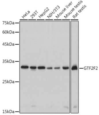 Western Blot RAP30 Antibody (3T7Q9)