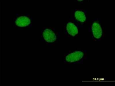 Immunocytochemistry/Immunofluorescence: RAP74 Antibody [H00002962-B01P] - Analysis of purified antibody to GTF2F1 on HeLa cell. (antibody concentration 10 ug/ml)