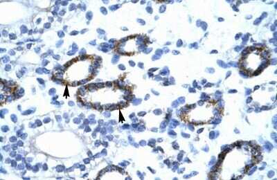 Immunohistochemistry: RAP30 Antibody [NBP3-17978] - Human kidney