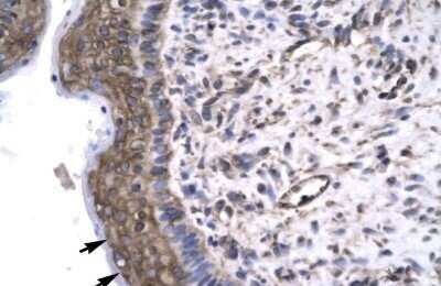 Immunohistochemistry: RAP30 Antibody [NBP3-17979] - Rabbit Anti-RAP30 antibody. Paraffin Embedded Tissue: Human Spermatophore. Cellular Data: Epithelial cells. antibody Concentration: 4.0-8.0 ug/ml. Magnification: 400X