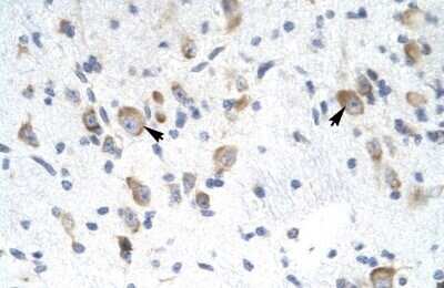 Immunohistochemistry: RAP30 Antibody [NBP3-17980] - Rabbit Anti-RAP30 antibody. Paraffin Embedded Tissue: Human Brain. Cellular Data: Neural Cells. antibody Concentration: 4.0-8.0 ug/ml. Magnification: 400X