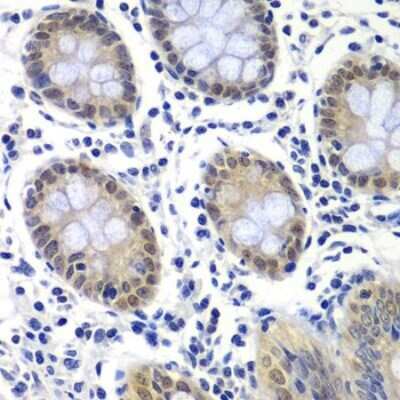 Immunohistochemistry: RAP30 Antibody [NBP3-17982] - Paraffin-embedded human colon using RAP74 .